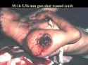 M193 Ball Exit Wound.jpg