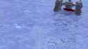 20 year old wrinkles.webm