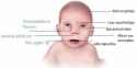 fetal-alcohol-syndrome-face-1024x516-2866146735.jpg